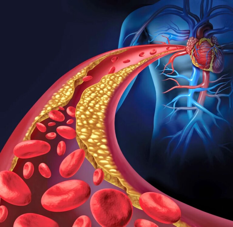 Come abbassare il colesterolo con l'alimentazione: ecco i 3 rimedi infallibili