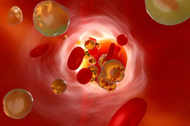 3 modi per abbassare il colesterolo con l’alimentazione: il primo è una regola d’oro